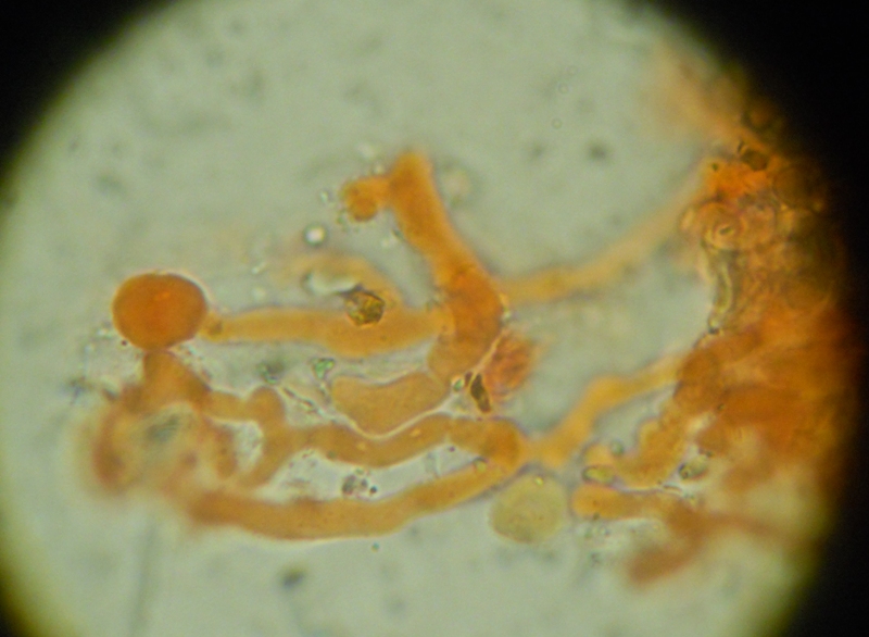 da determinare (Hyphodermella corrugata)